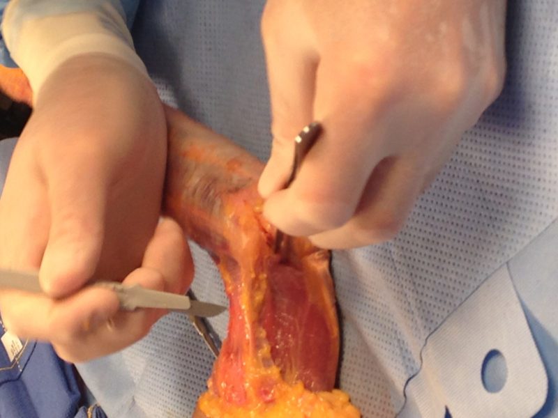 Exploring Hand Therapy